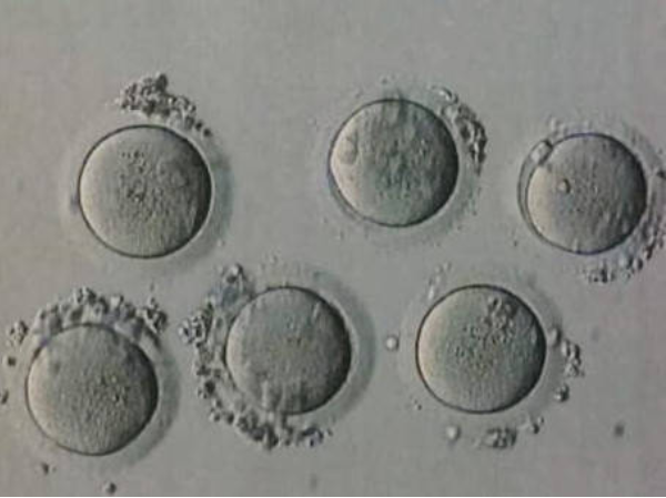 一分钟告诉你5个胚胎要不要养囊，成功率高低影响因素多