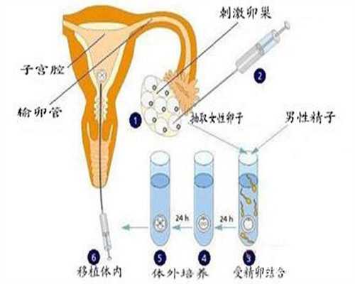 南宁试管婴儿医院选择指南与助孕经验分享