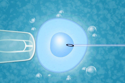 产后腰痛麻胀困扰？了解这些护理要点助您恢复