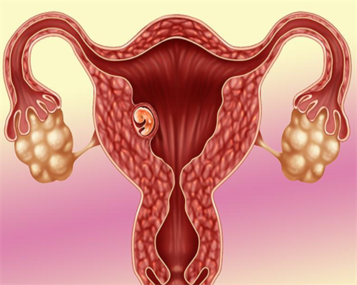 2026第三代供卵试管生男孩条件详解