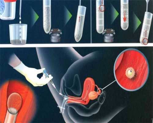 南宁地区试管婴儿费用概览与成功率分析