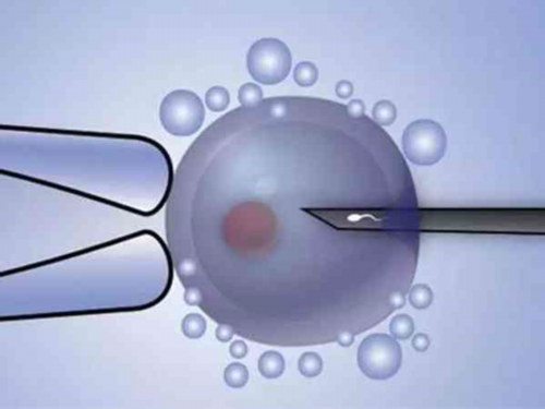 南宁地区试管助孕指南:广西壮族自治区人民医院的费用与政策解析