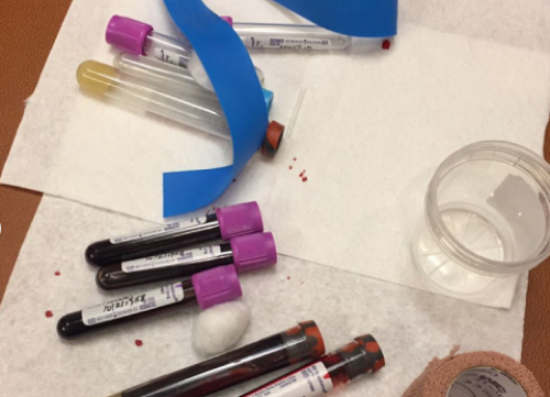 广西供卵怎么选 广西壮族自治区人民医院试管费用： ‘孕囊看男女真实数据’