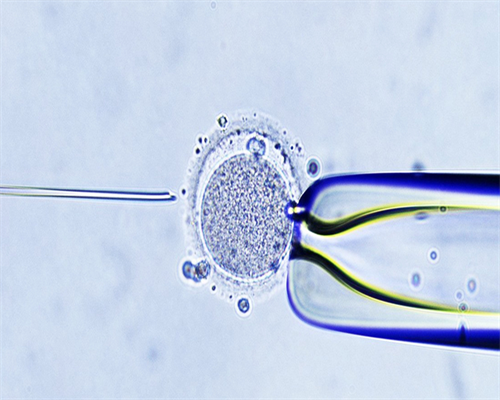 广西哪里做代生 广西壮族自治区人民医院试管成功率： ‘孕囊看男女准的’