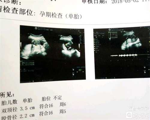 代孕的前兆是什么_郑州代孕双胞胎案件