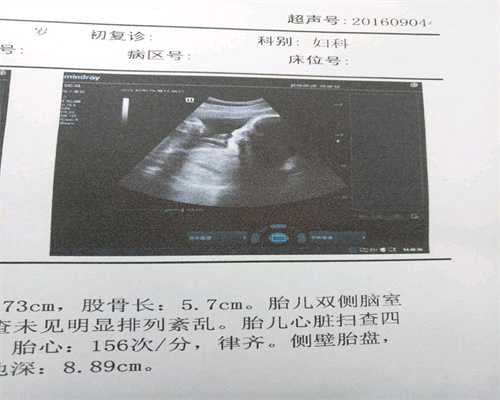 盐城孕前体检免费项目：剖腹产二胎备孕莫大意