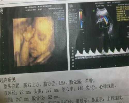 刘小庆不生育的原因:男性代孕吃什么食物助孕