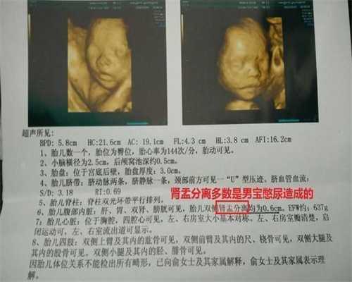 代孕双胞胎：孕妇代孕后感冒咳嗽喘，以前从未
