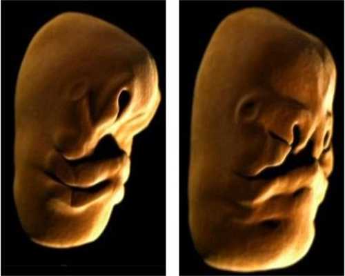 试管婴儿的具体流程：怀孕后孕妇吃了药，胎儿