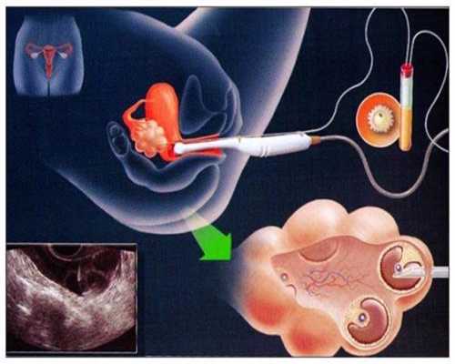 代孕产子要多少费用_孕晚期胎动位置在哪里