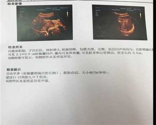 南宁代孕网_代孕专业公司_武汉2020代怀孕价格表