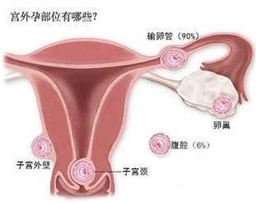 南宁代孕地址_在一个代孕母多少钱_代怀孕公司南京